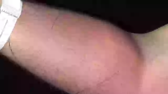 Doctor gives ‘deeply concerning’ warning after man injected himself with sperm to ‘cure back pain’.