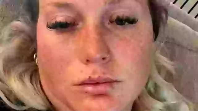 Woman issues terrifying warning after common beauty procedure left her ‘partially paralyzed’