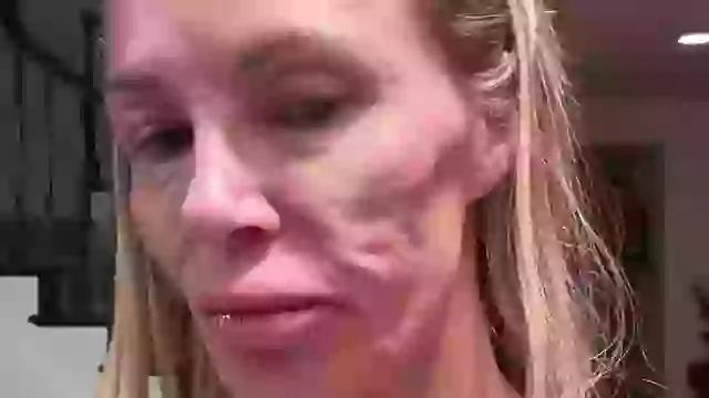 How Brandi Glanville believes she got facial ‘parasite’ that caused her to lose five teeth and $70,000.