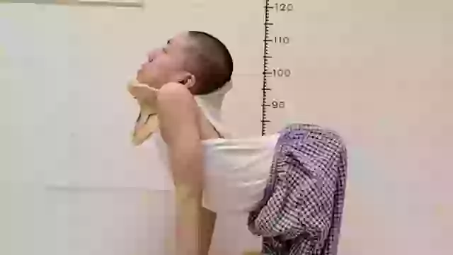 ‘Folded boy’ stands up straight for the first time after spine was contorted at 180-degree angle most of his life.