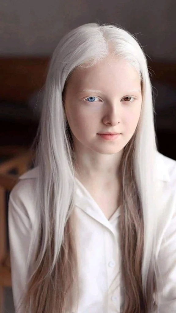 A young girl with long white hair and two differently colored eyes, sitting indoors and looking calmly at the camera.
