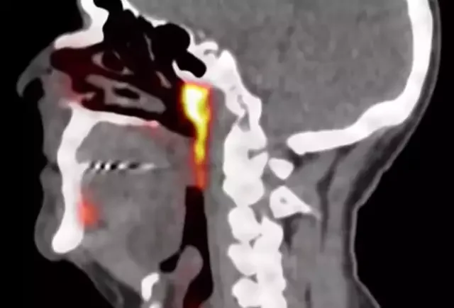 It was discovered through 'sensitive' scans