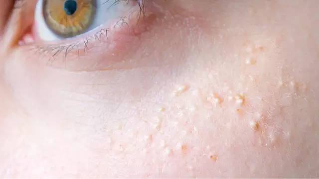 Reason behind series of white spots on your body and private parts as experts issue serious warning.