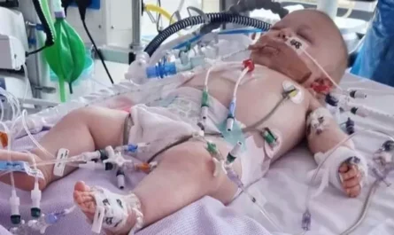 common cold symptoms.alt