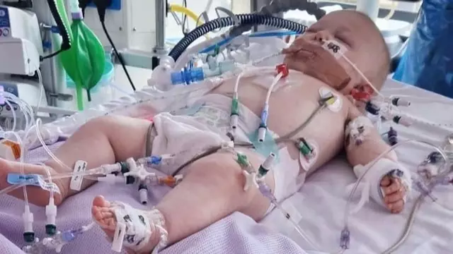 Heartbroken mother speaks out after 4-month-old baby’s common cold symptoms turned out to be rare blood cancer.