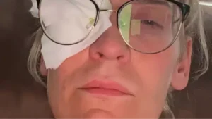 Woman Went Blind After Making a ‘Stupid’ Contact Lens Mistake